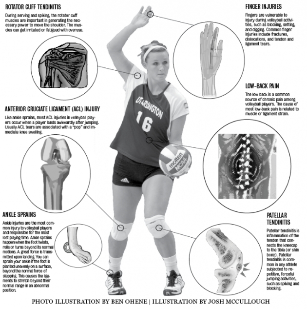 What Accidents or Injuries May Occur When Playing Volleyball? How to Deal with Emergencies